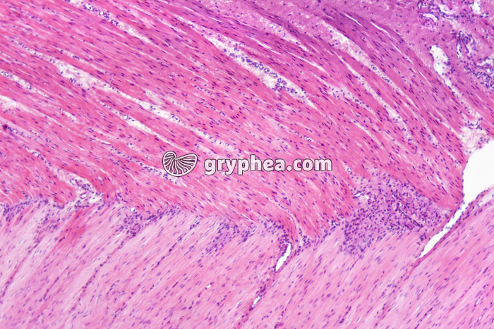 Fibres musculaires lisses x25 - gryphea.com